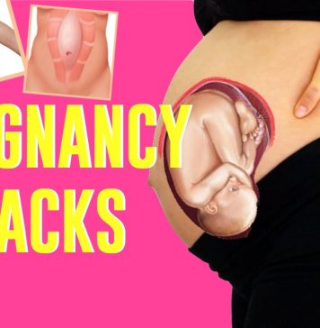 Pregnancy Hacks: How to Prevent Stretch Marks